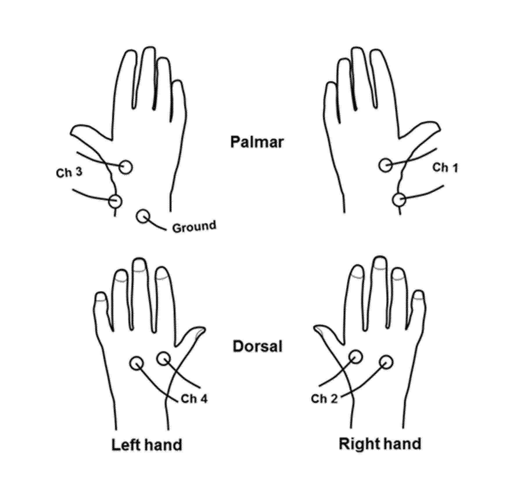 Detection Of Disease Using Gesture Writing Bio-Markers