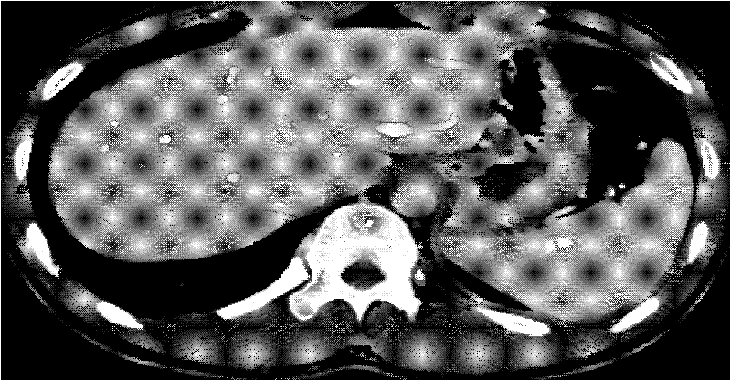 Method for enhancing liver blood vessel and simultaneously dividing liver from blood vessel in CTA (computed tomography imaging) image