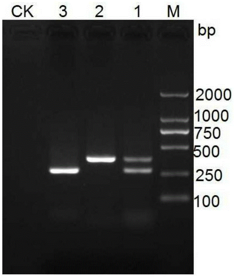 A molecular detection kit for Chestnut Phytophthora and its application method