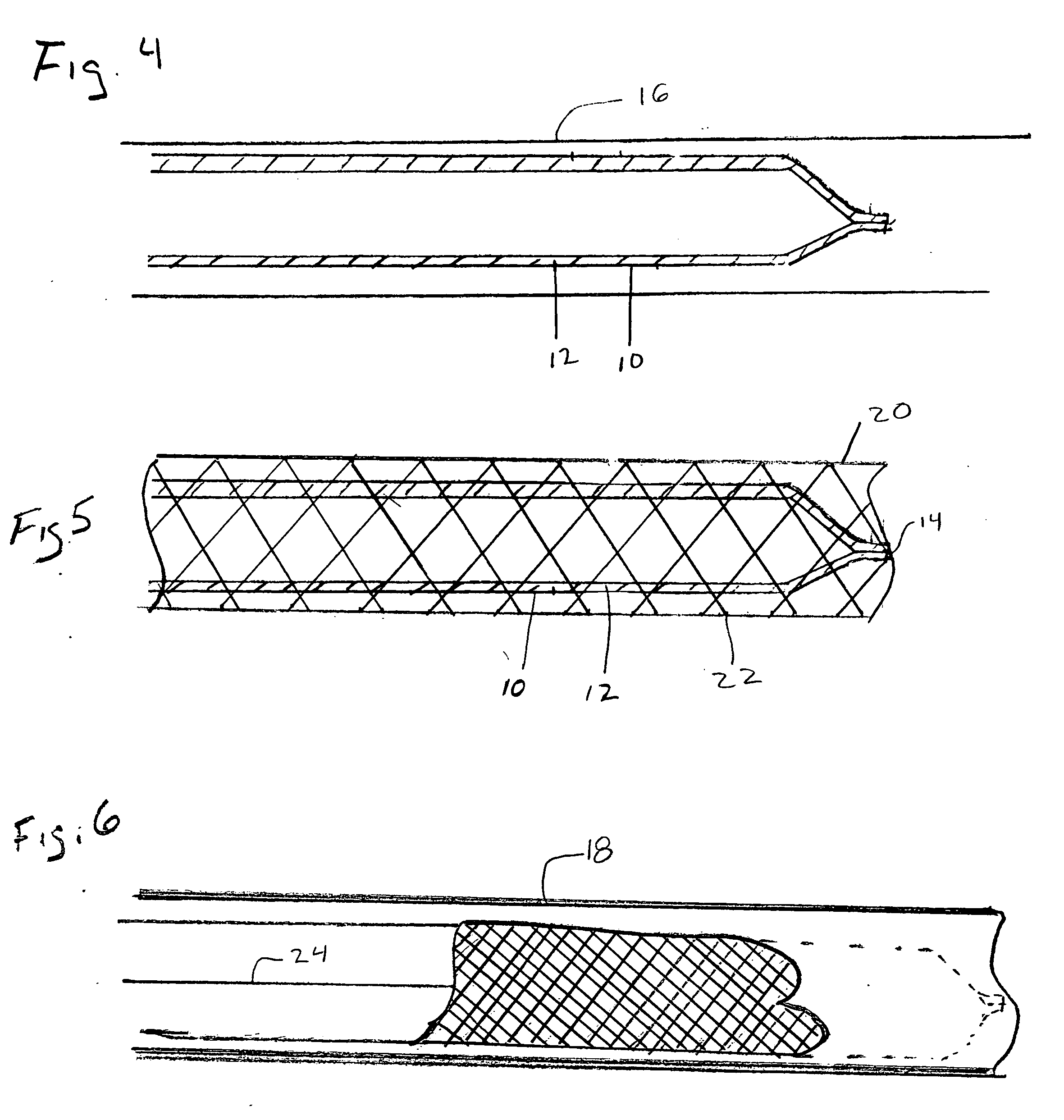 Removable duct liner