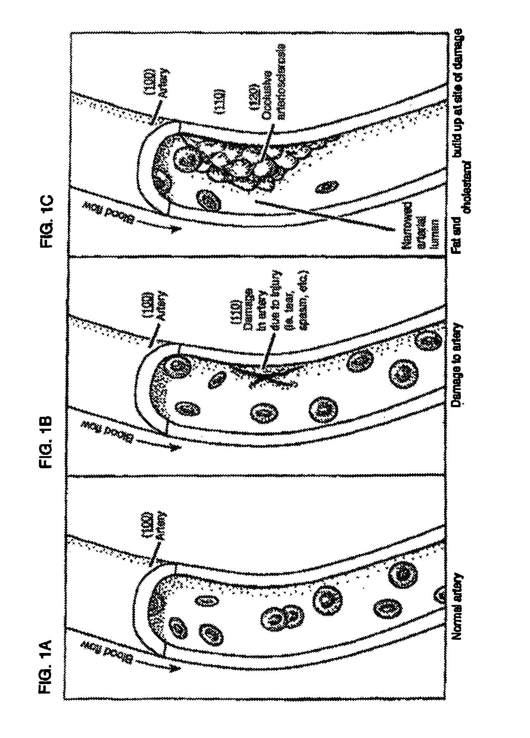 High-viscosity hyaluronic acid compositions to treat myocardial conditions