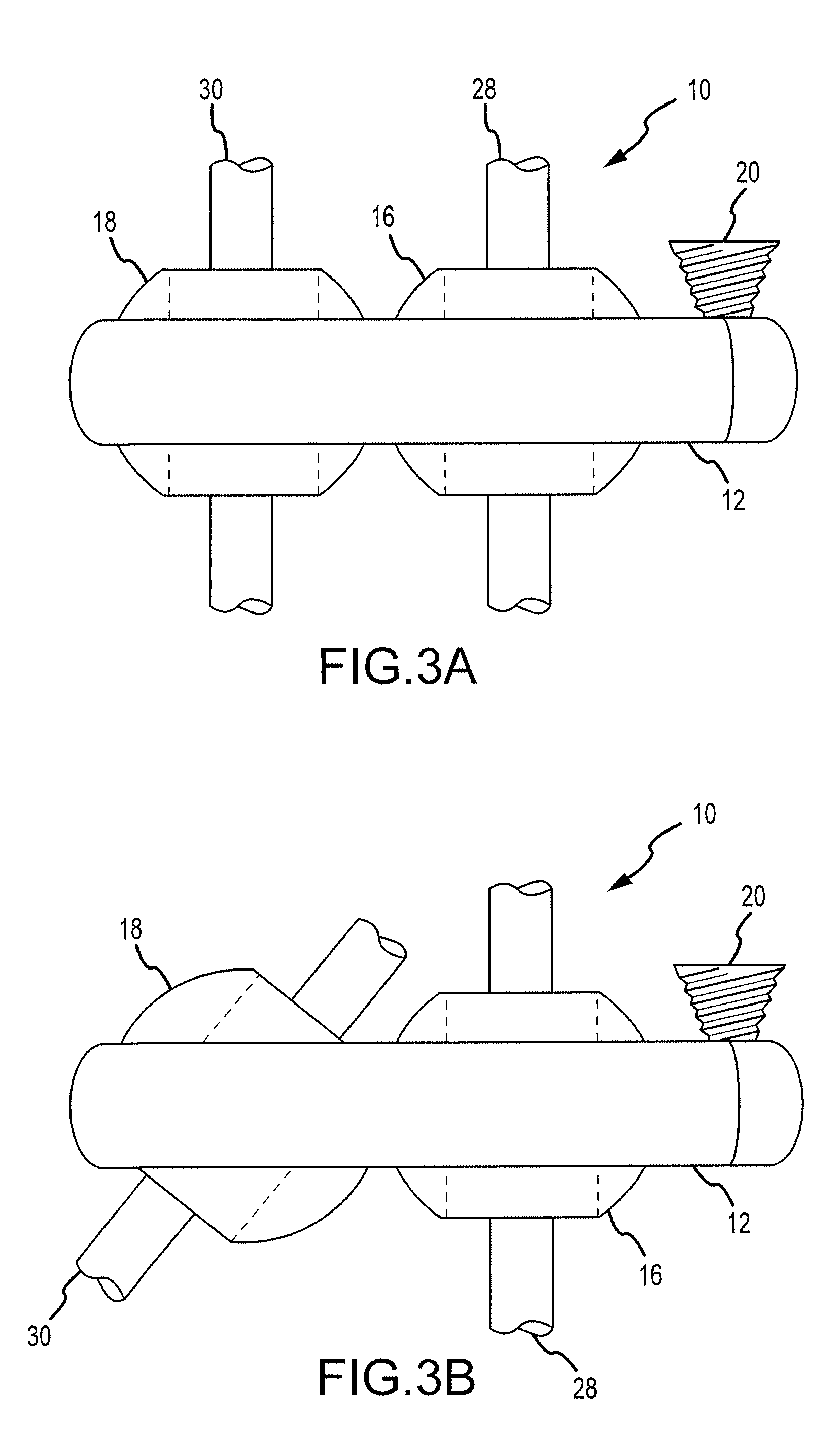 System and method for spinal instrumentation