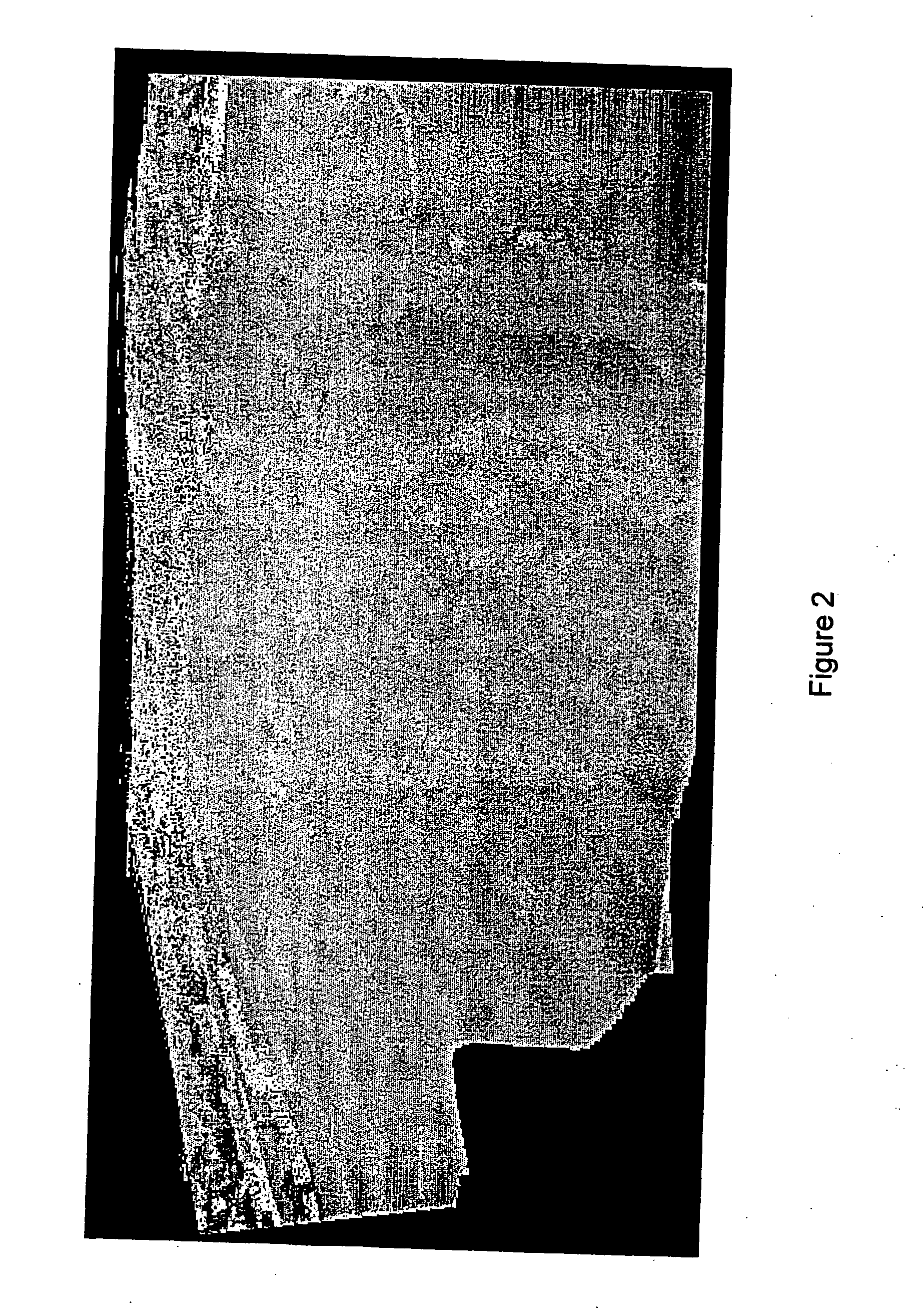 Method and system for estimating global motion in video sequences