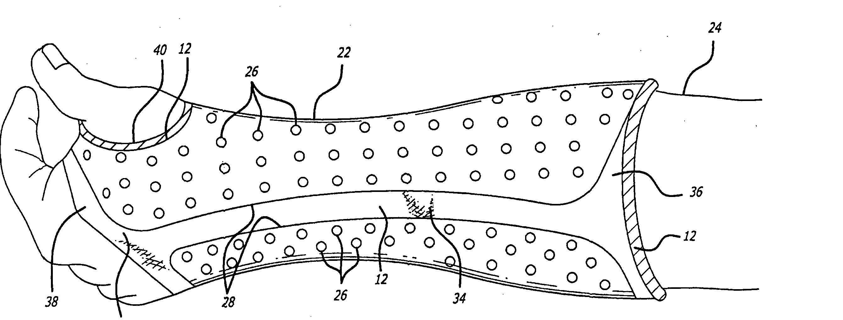 Cast assembly with breathable double knit type padding