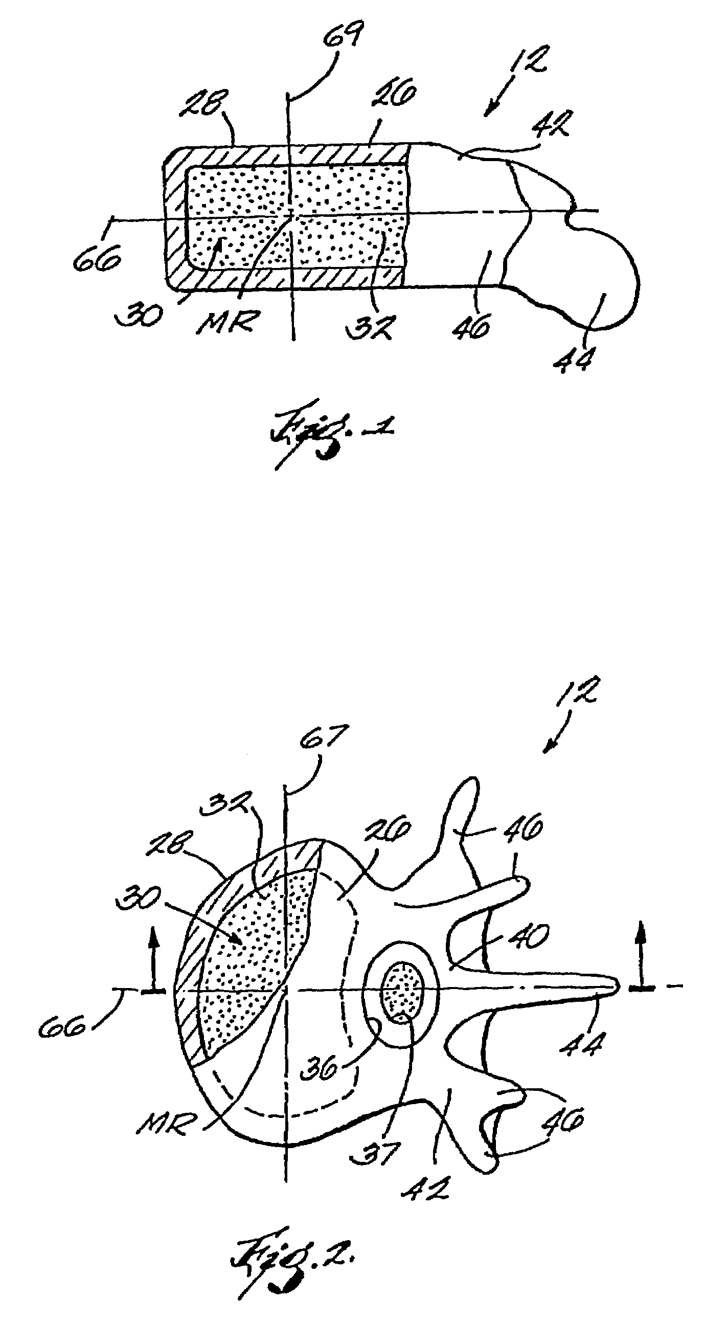 Expandable structures for deployment in interior body regions