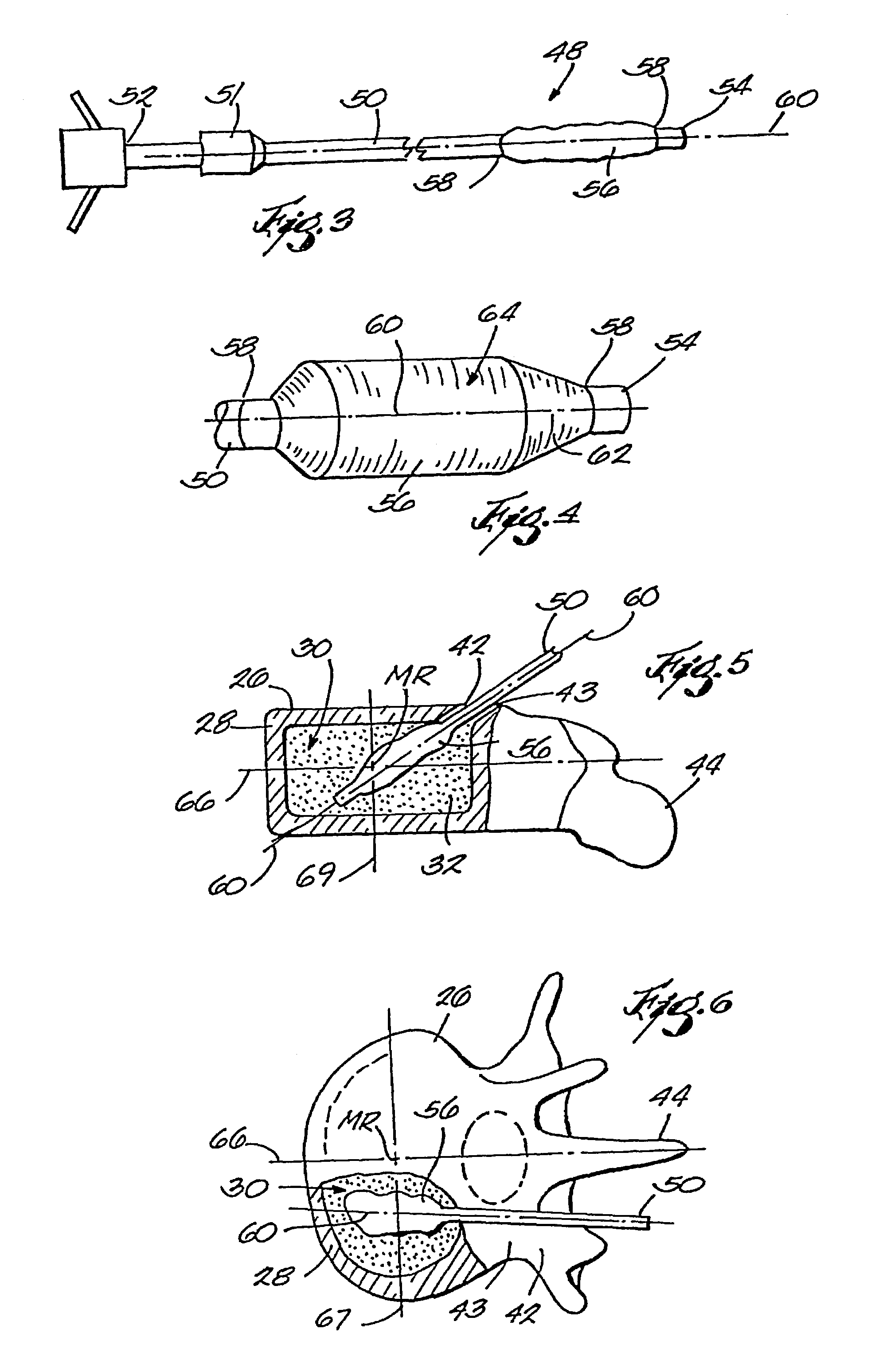 Expandable structures for deployment in interior body regions