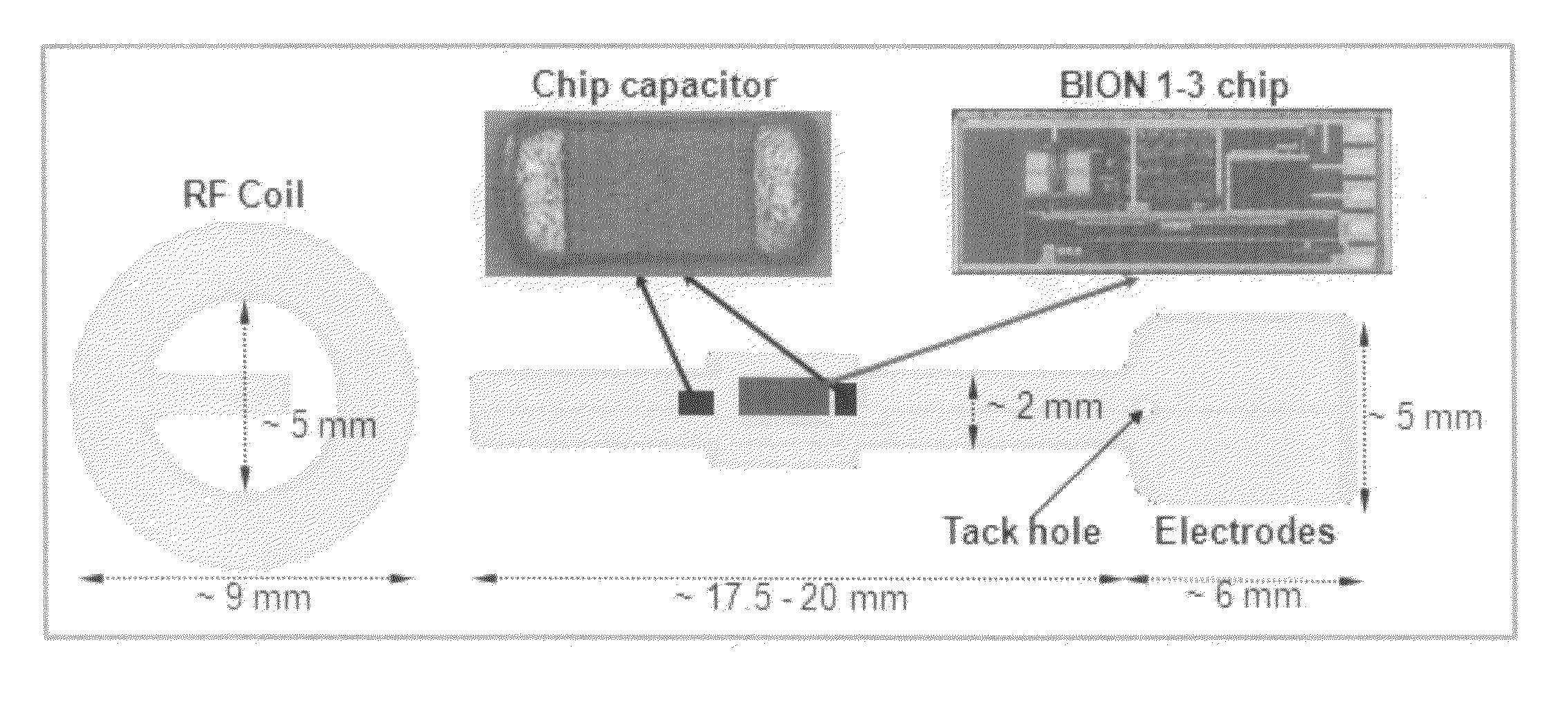 Pocket-enabled chip assembly for implantable devices