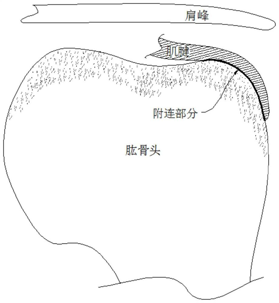 Anchor system for rotator cuff injury repair and using method thereof