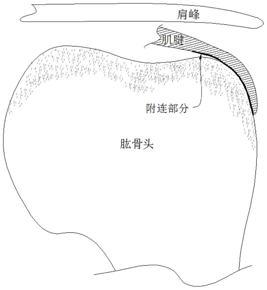 Anchor system for rotator cuff injury repair and using method thereof