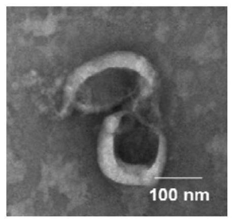 Anti-tumor engineering exosome, preparation method and application