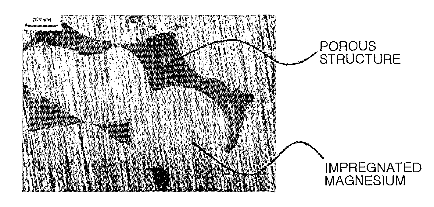 Composite implant having porous structure filled with biodegradable alloy and method of magnesium-based manufacturing the same