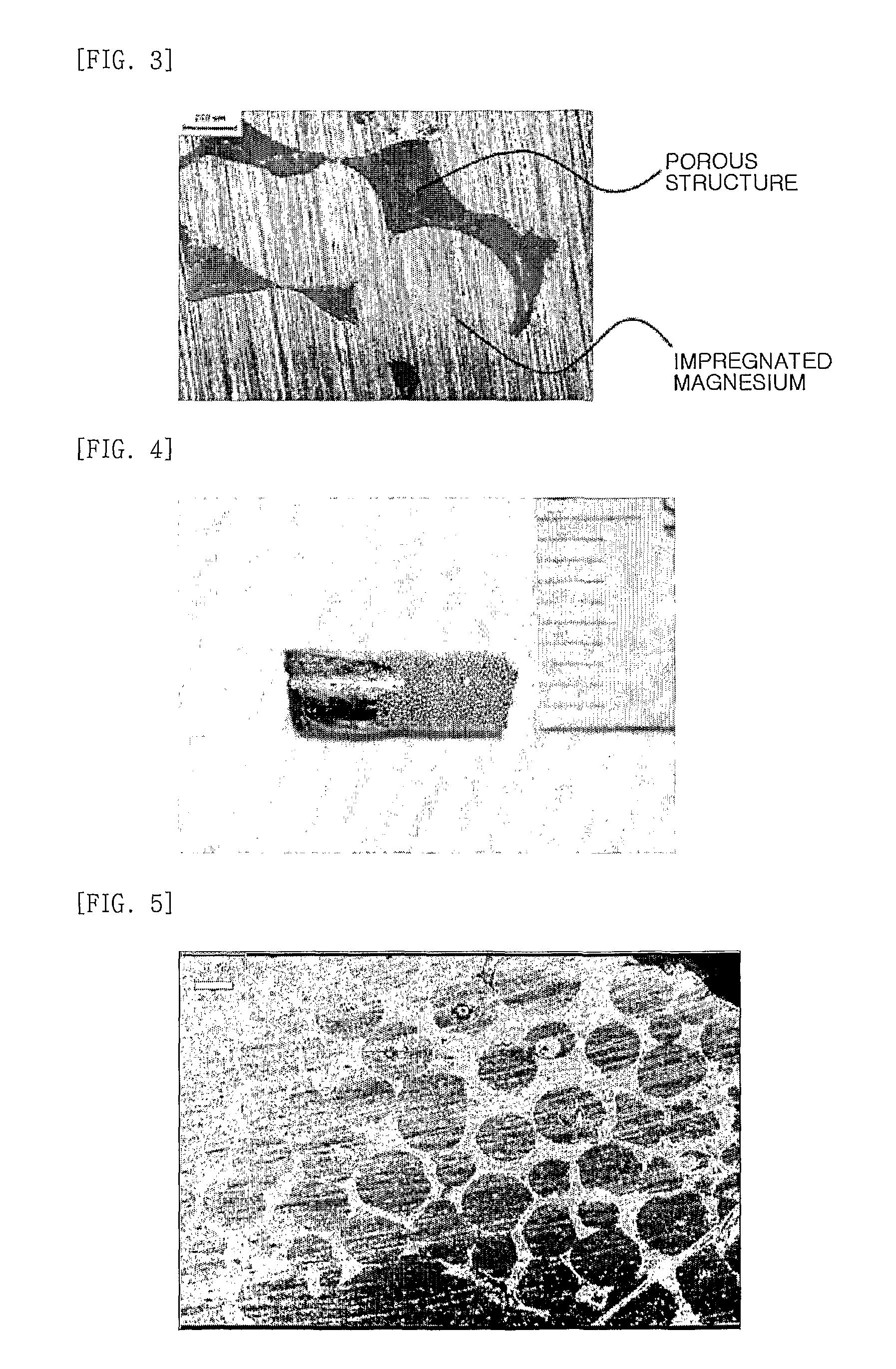 Composite implant having porous structure filled with biodegradable alloy and method of magnesium-based manufacturing the same