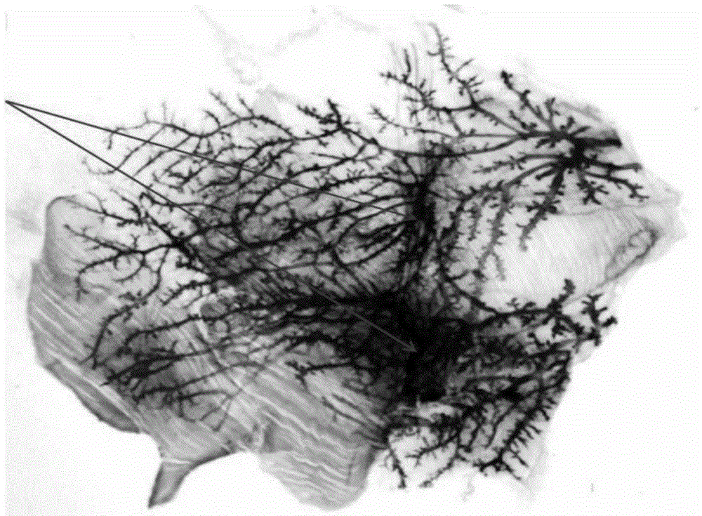 Tumor naked eye visible nanometer tracer agent and preparation method thereof