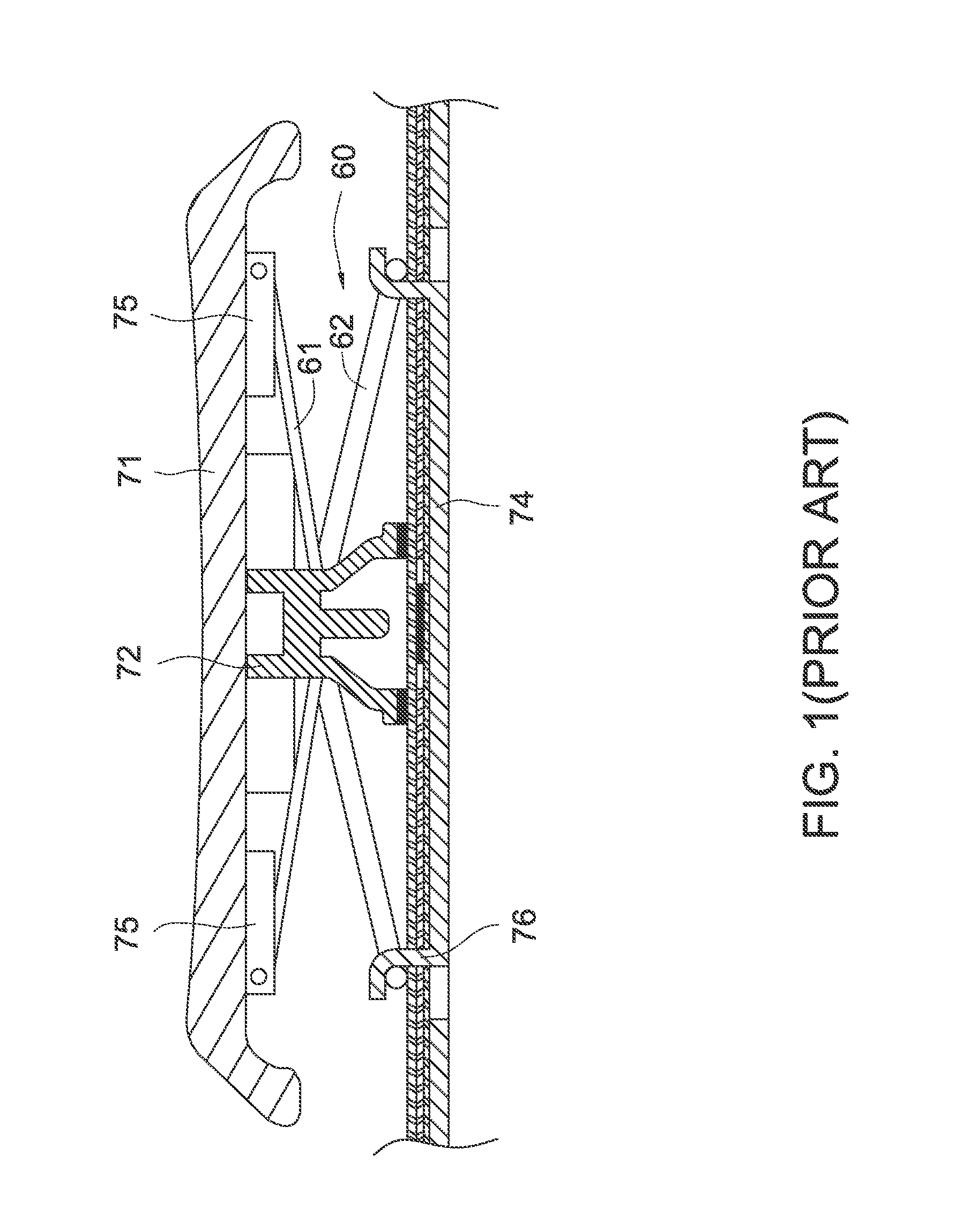 Depressible key structure