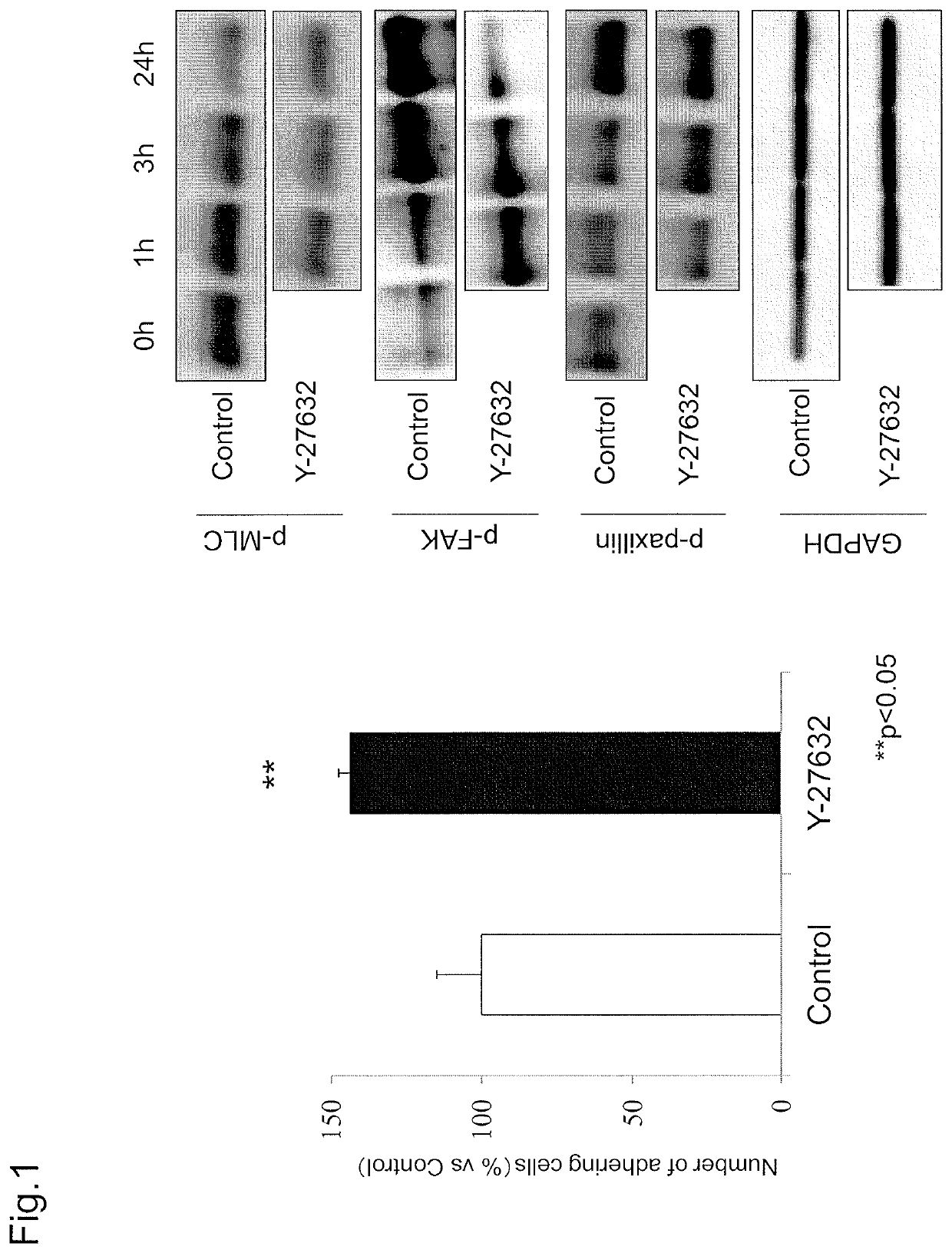 Combined agent for cell therapy of corneal endothelial cell