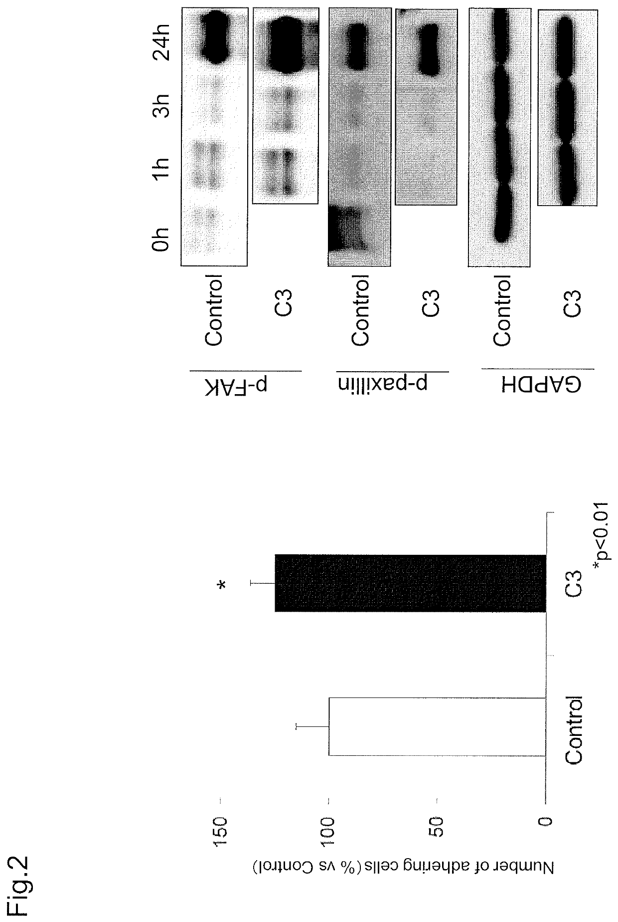 Combined agent for cell therapy of corneal endothelial cell