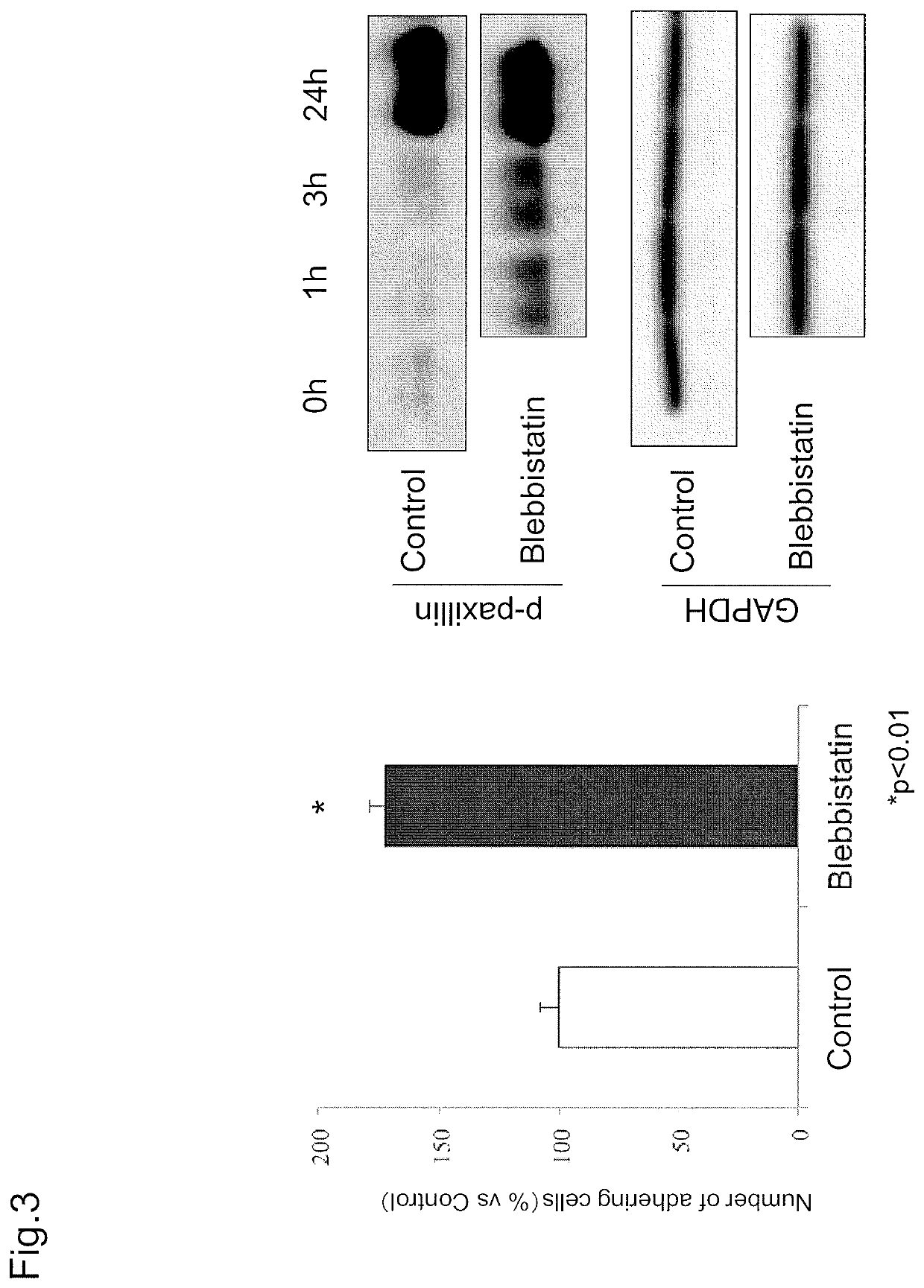 Combined agent for cell therapy of corneal endothelial cell