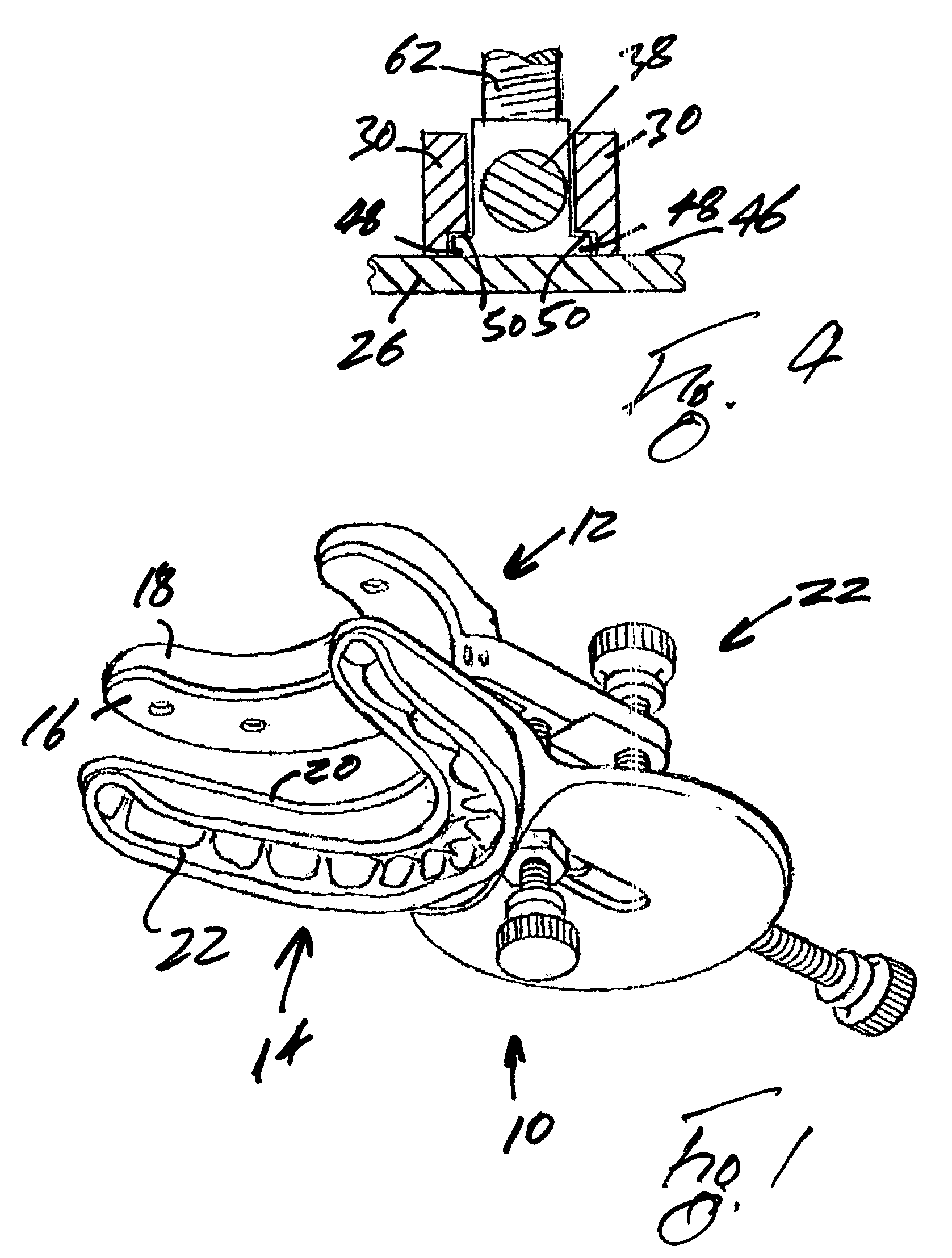 Mandible positioning devices