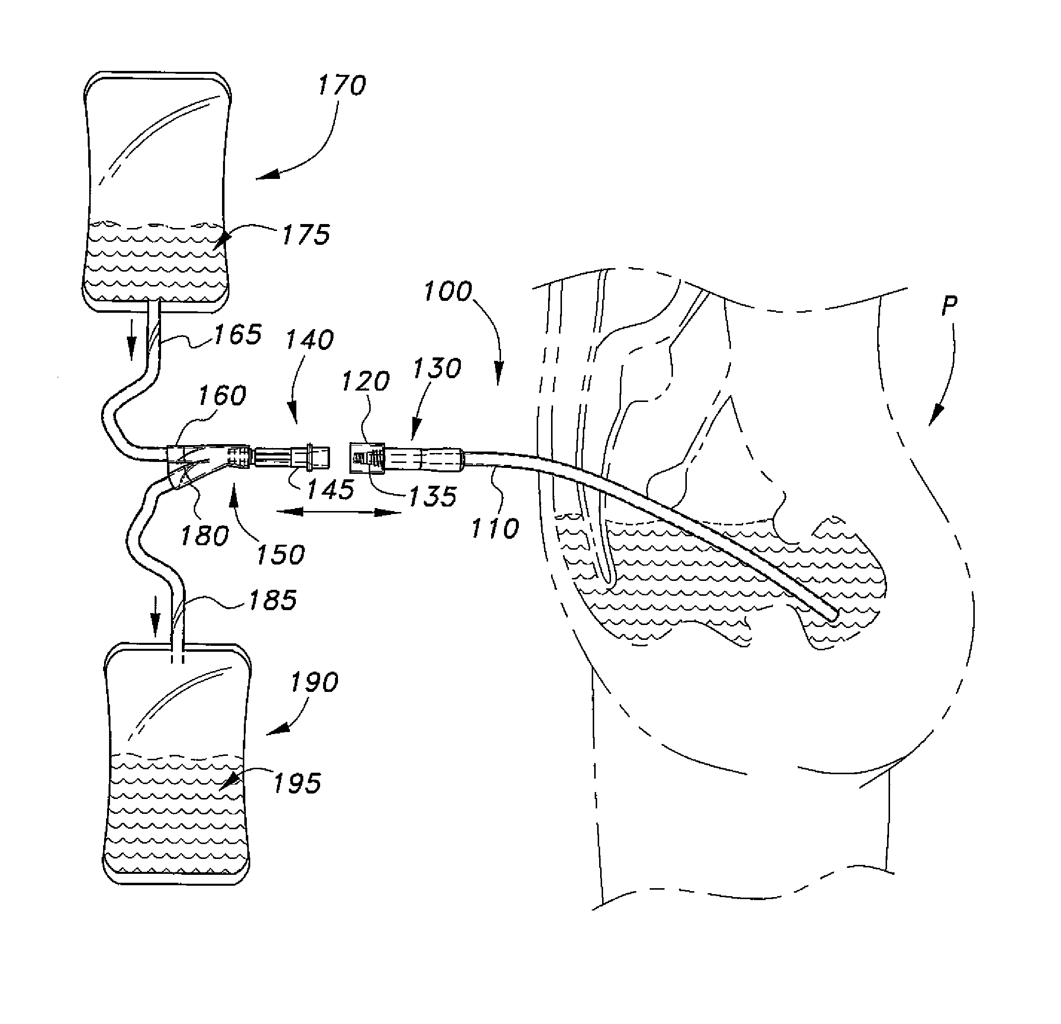 Peritoneal dialysis catheter