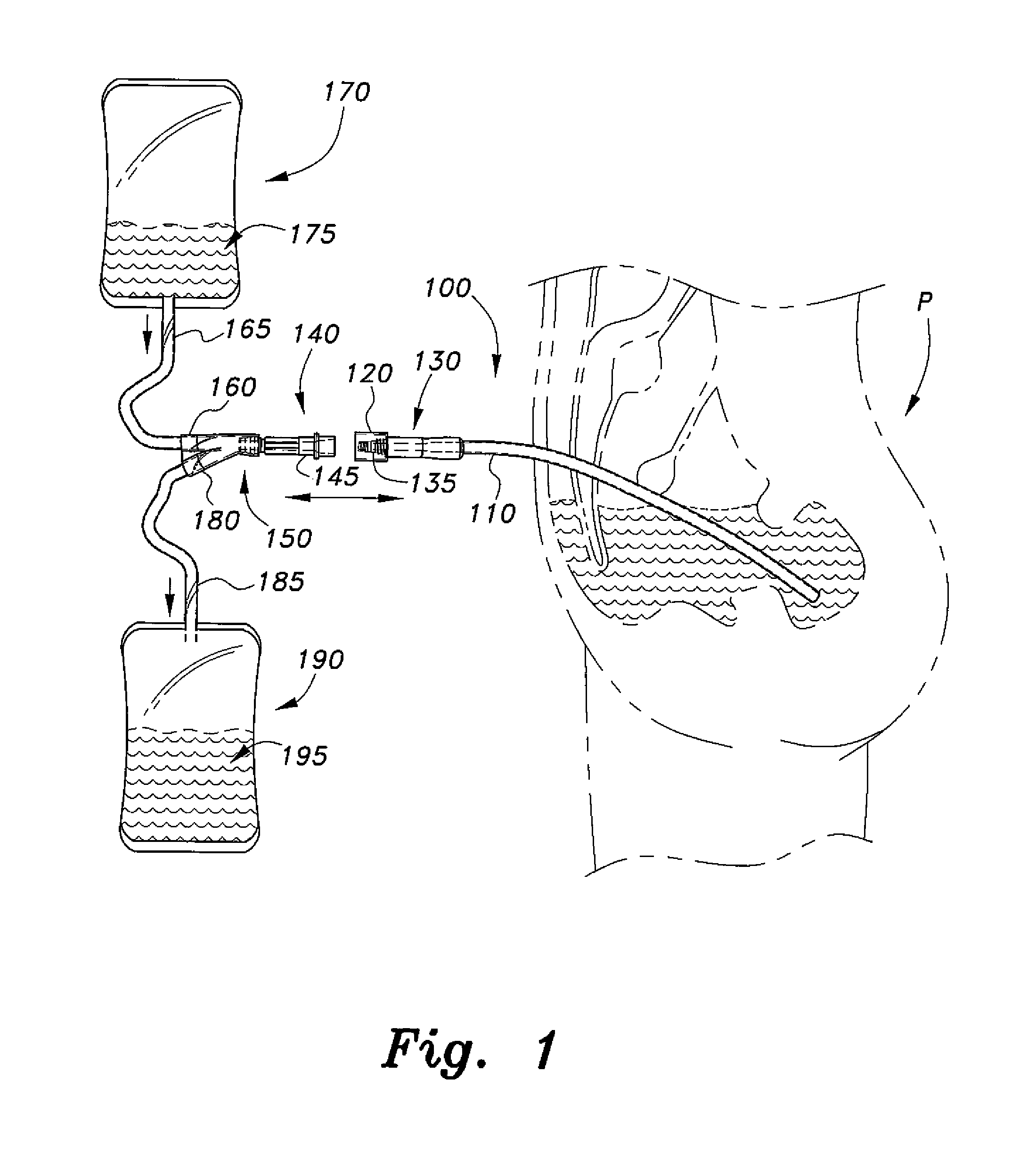 Peritoneal dialysis catheter