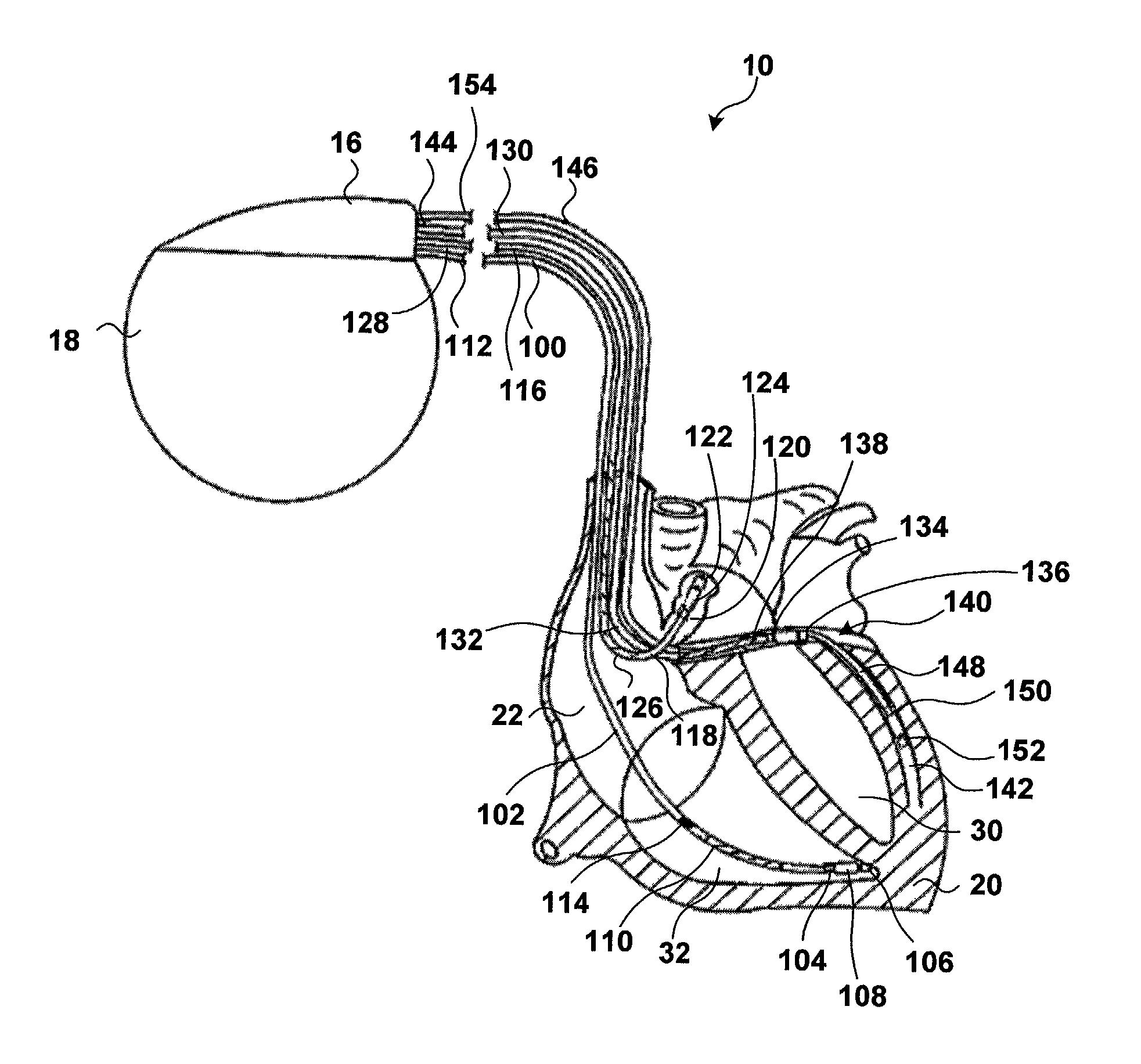 Cardiac output measurement using dual oxygen sensors in right and left ventricles