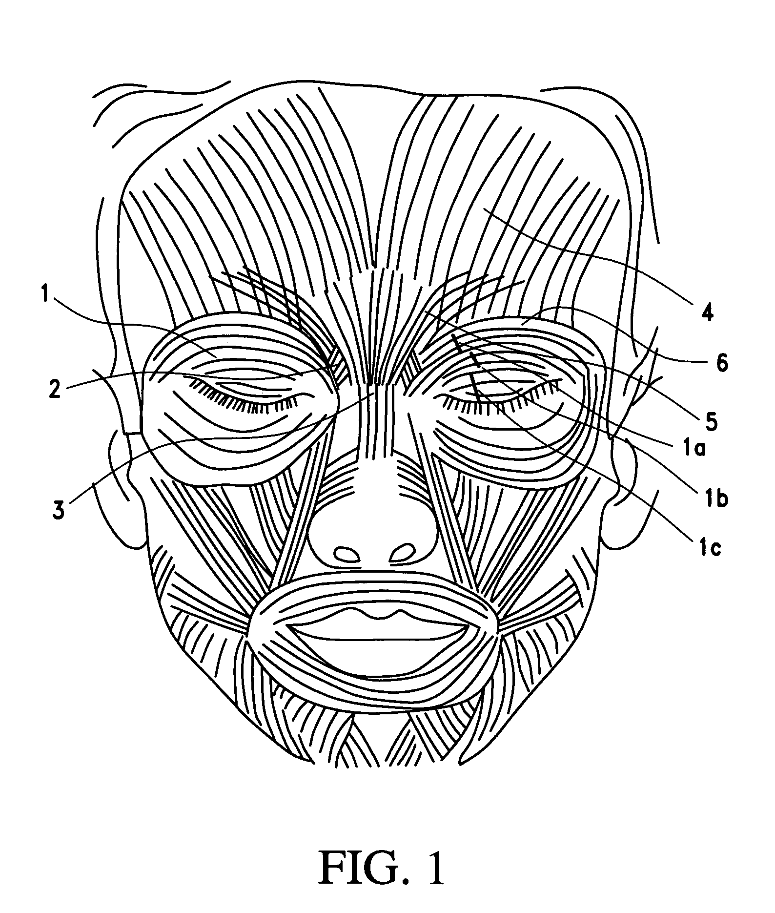 Cosmetic use of botulinum toxin for the treatment of eyebrow and forehead ptosis, and unwanted eyebrow expression