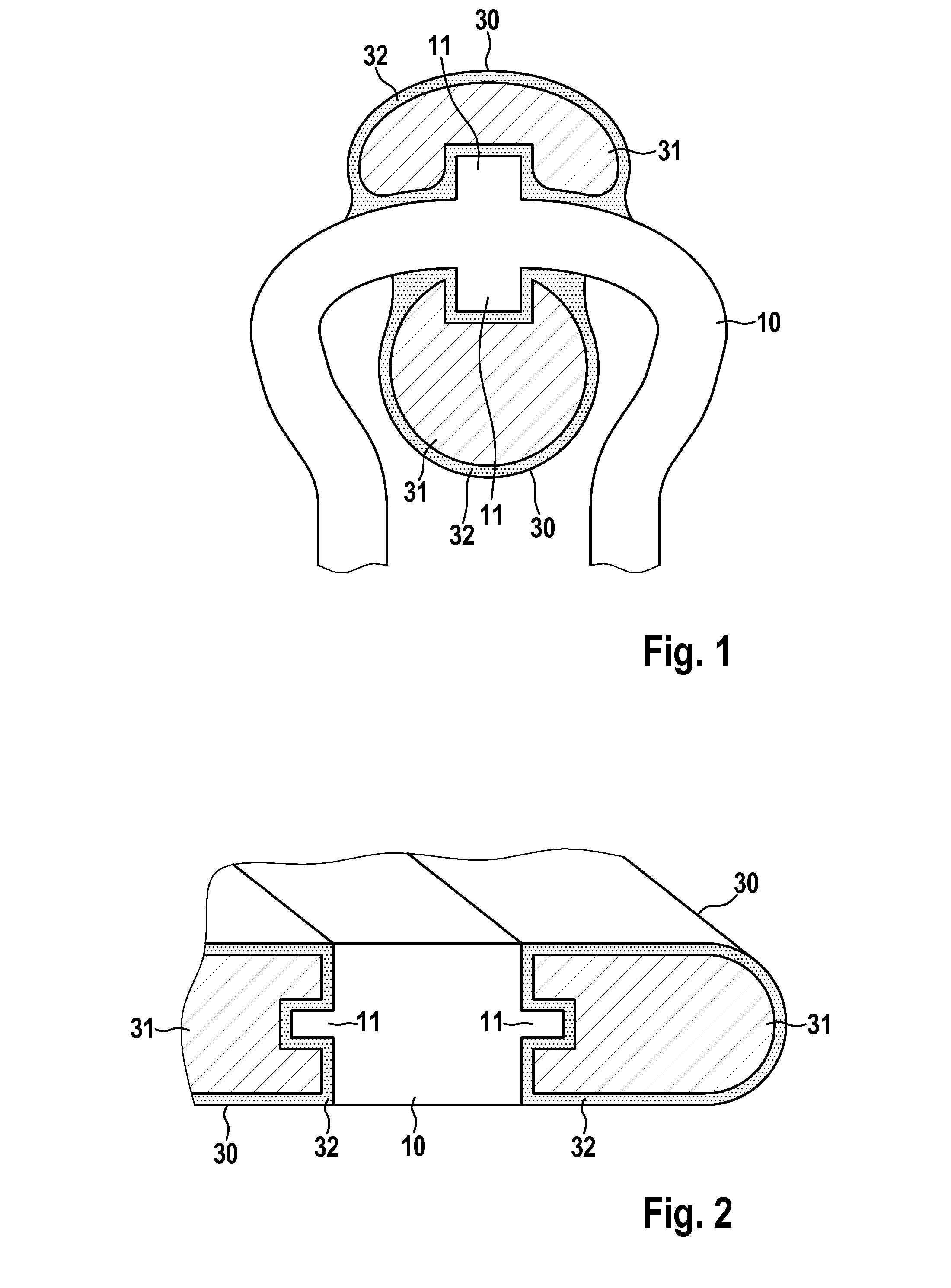 Endoprosthesis