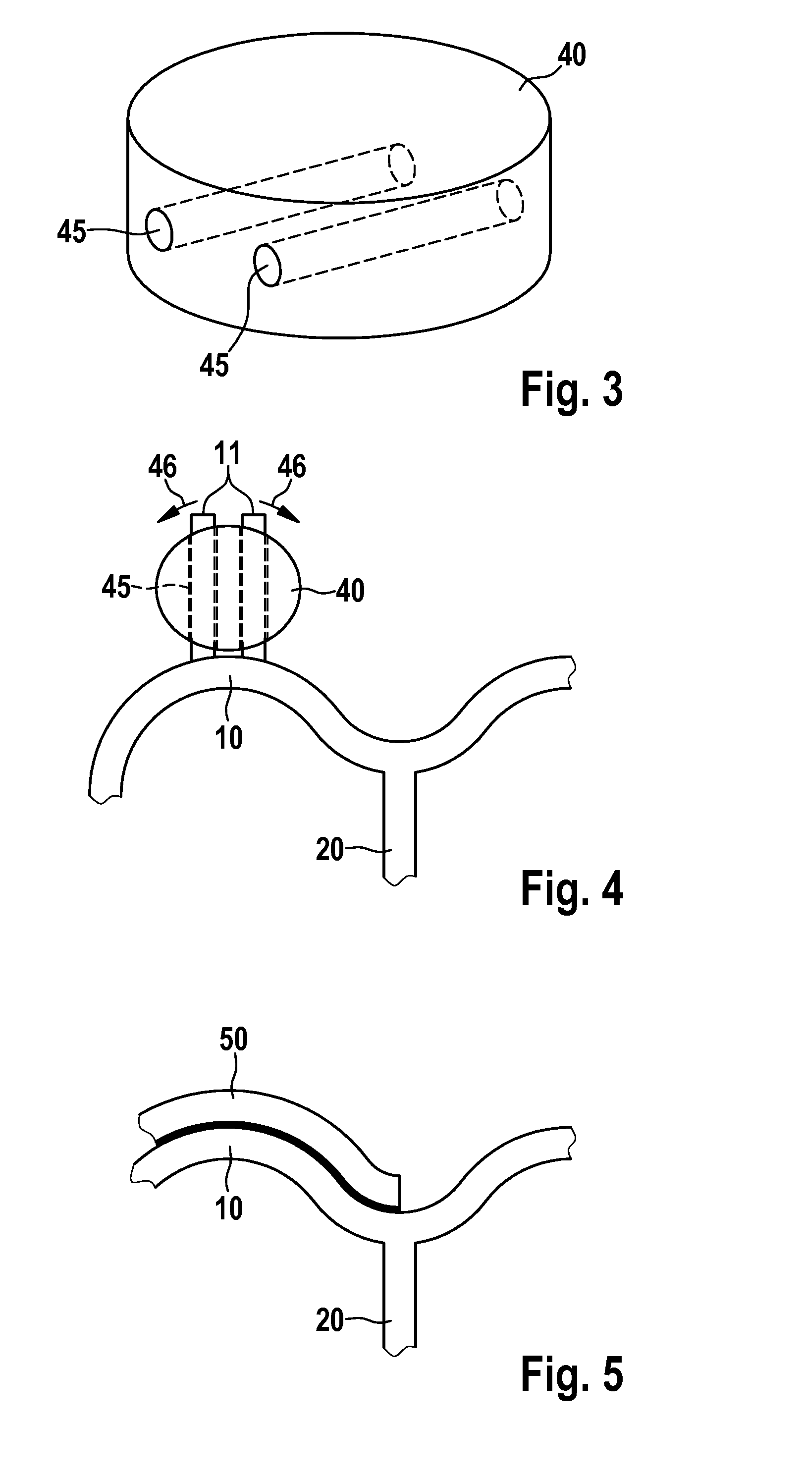 Endoprosthesis