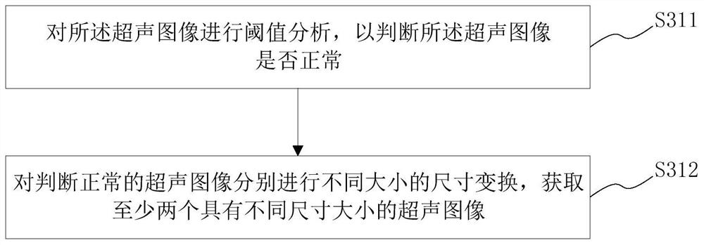 Ultrasonic image segmentation system and method based on side window attention mechanism