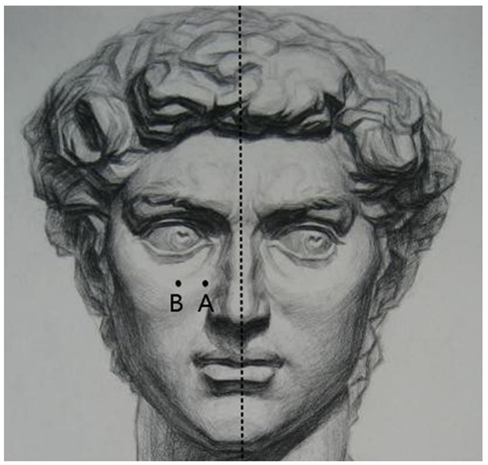 Living body detection method and device based on near-infrared camera