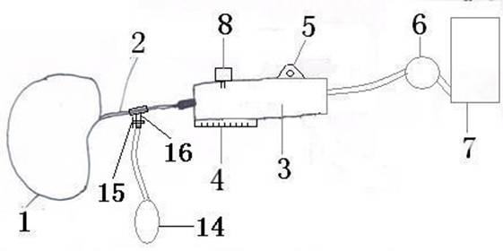 An automatic constant pressure skin dilator