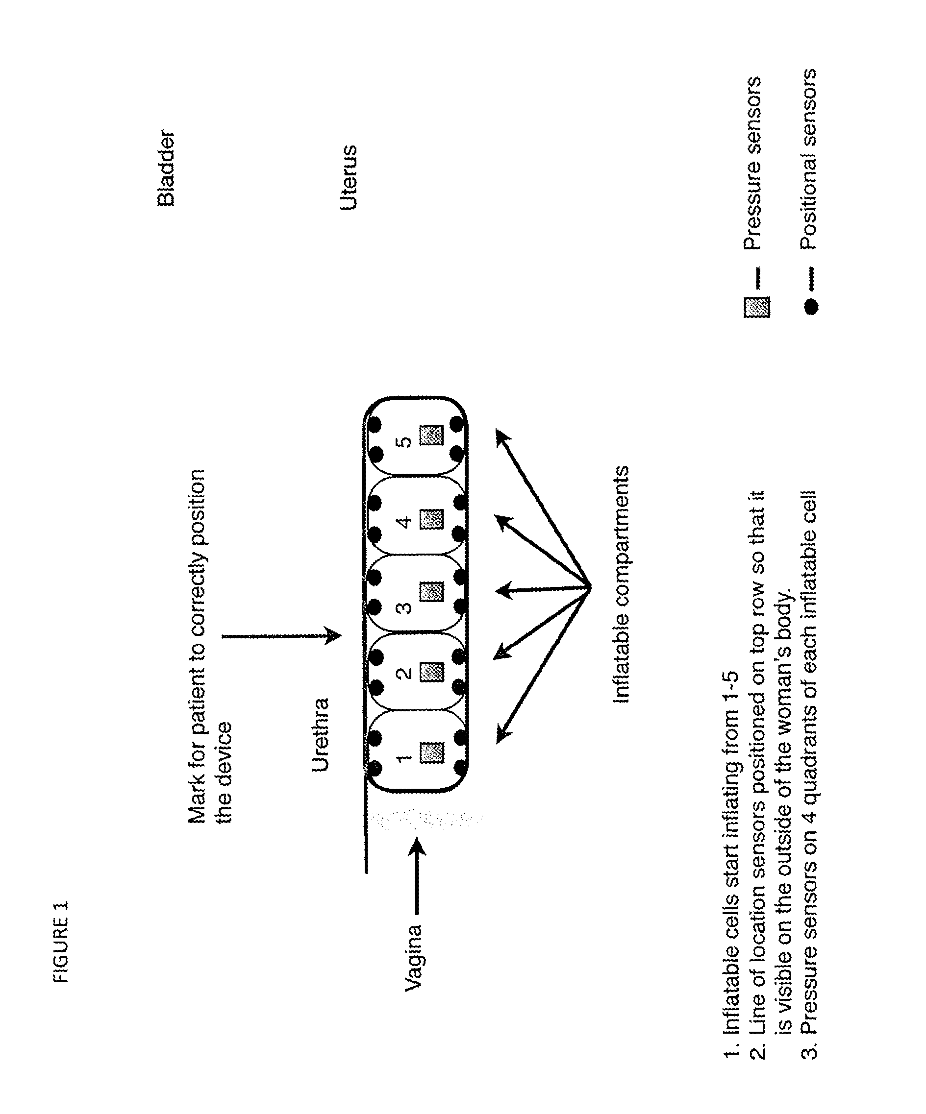 Treatment of pelvic organ prolapse