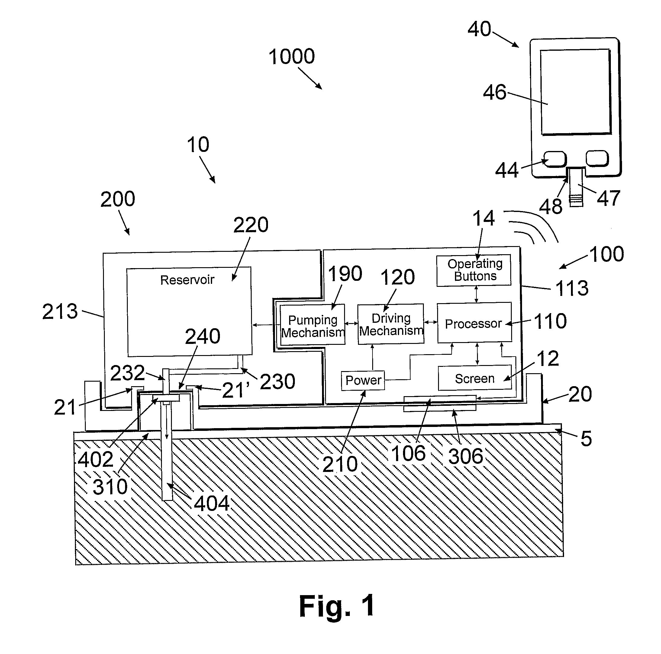 Portable infusion device with means for monitoring and controlling fluid delivery