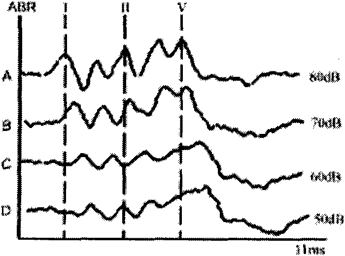 Evoked potential recorder based on time characteristic indicators