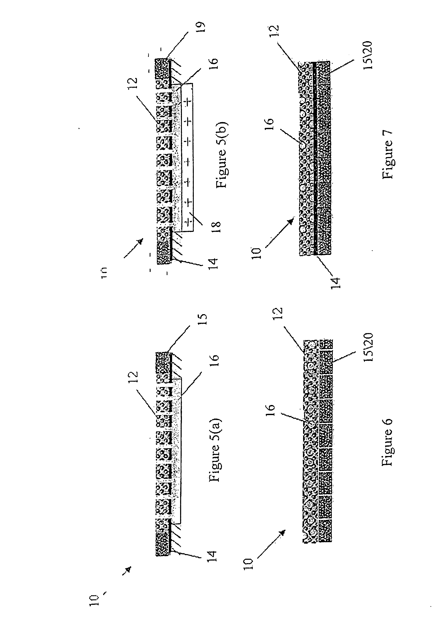 Lumen - supporting devices and methods of making and using