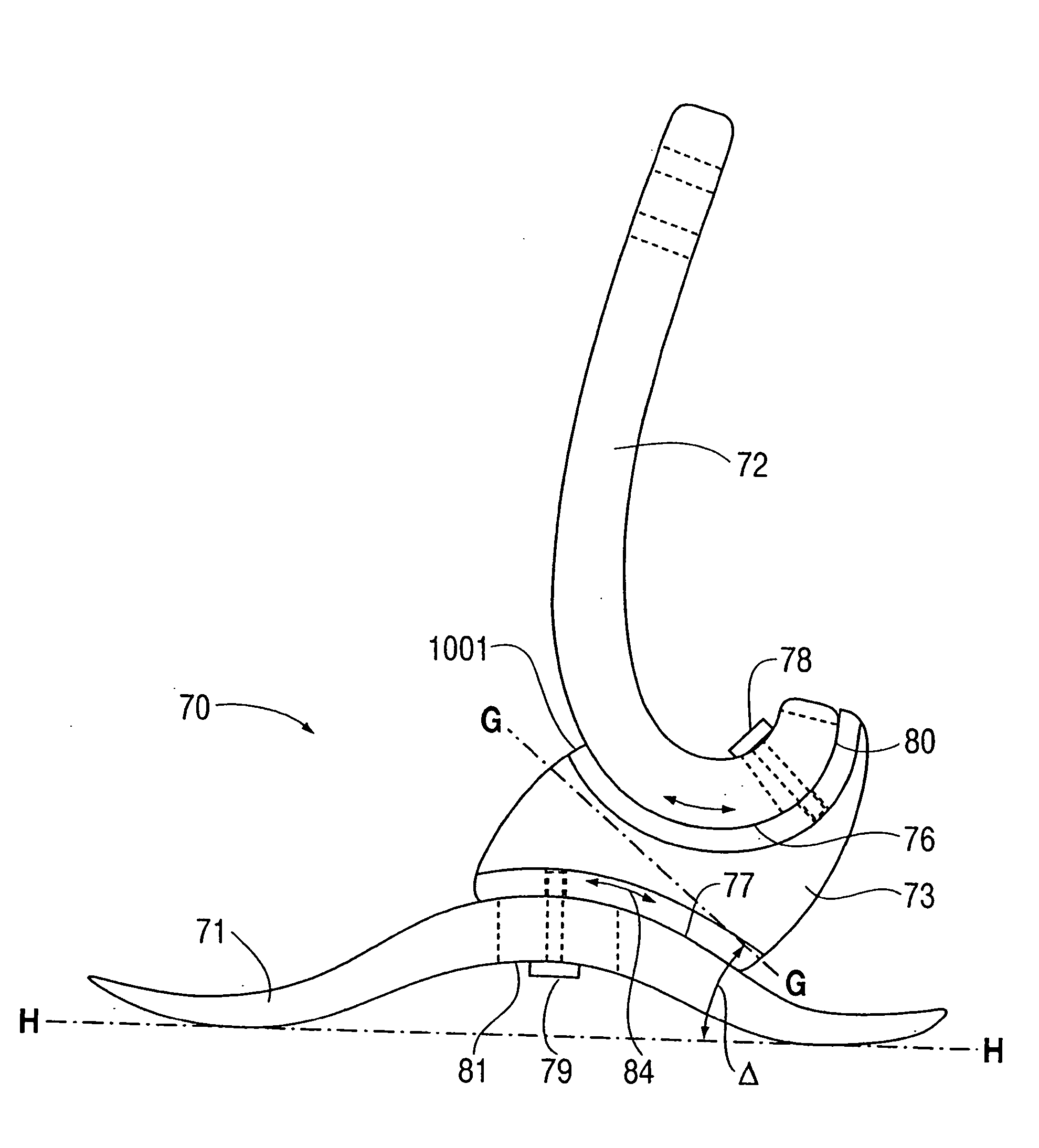 Prosthetic foot with tunable performance