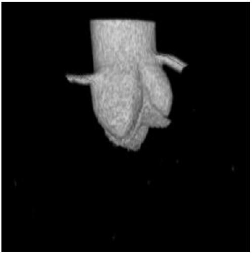 Coronary flow reserve calculation method based on myocardial blood flow and CT (Computed Tomography) image