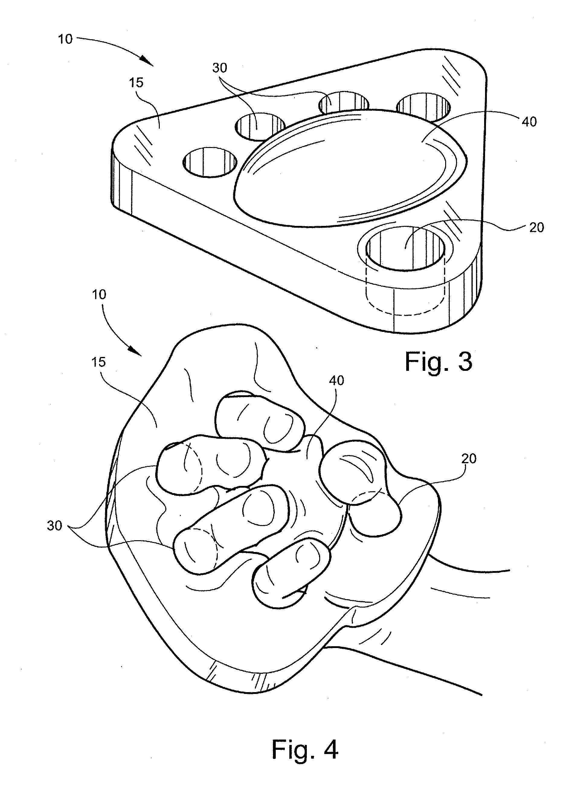 Hand exerciser