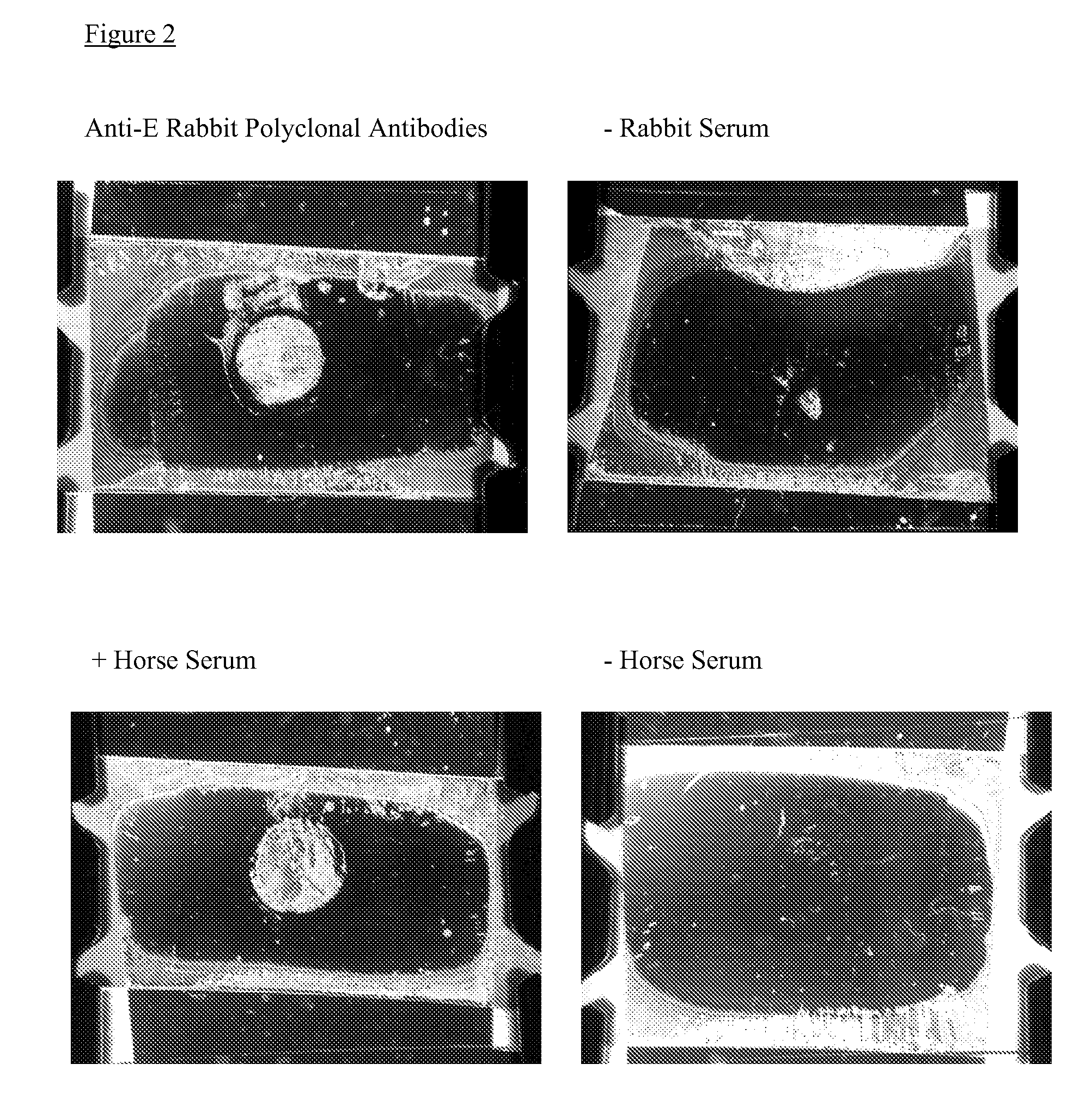 Liquid crystal based analyte detection