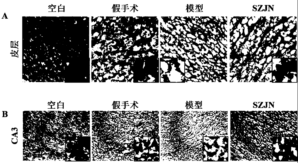 Application of ginseng and jujube brain-strengthening oral liquid to preparation of drug for preventing and/or treating Alzheimer disease (AD)