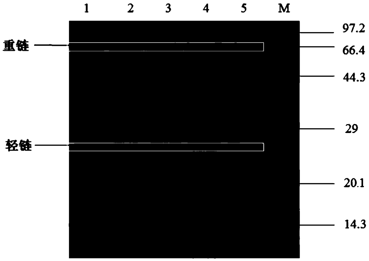 Anti-vibrio brilliant yolk antibody and preparation method thereof