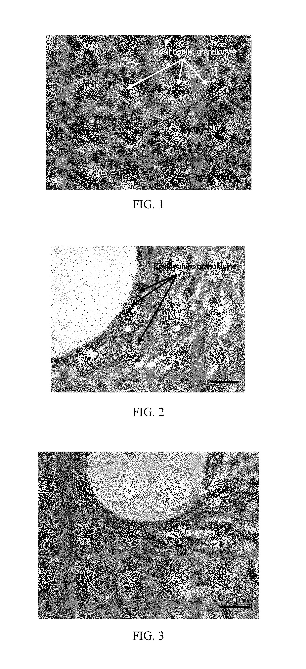 Implanted Device