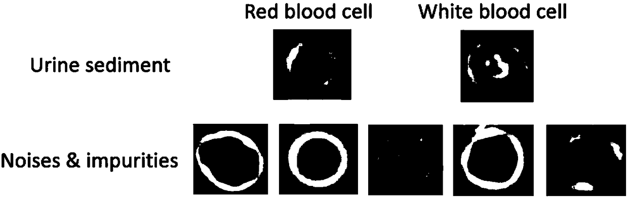 ACF-based urine sediment detection method