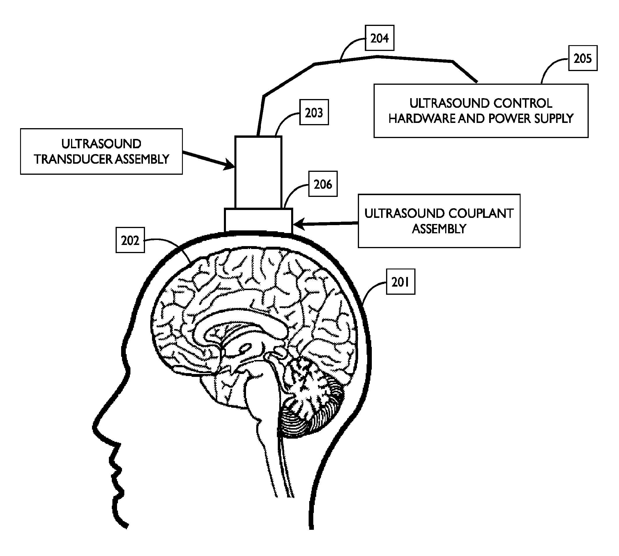 Systems and devices for coupling ultrasound energy to a body