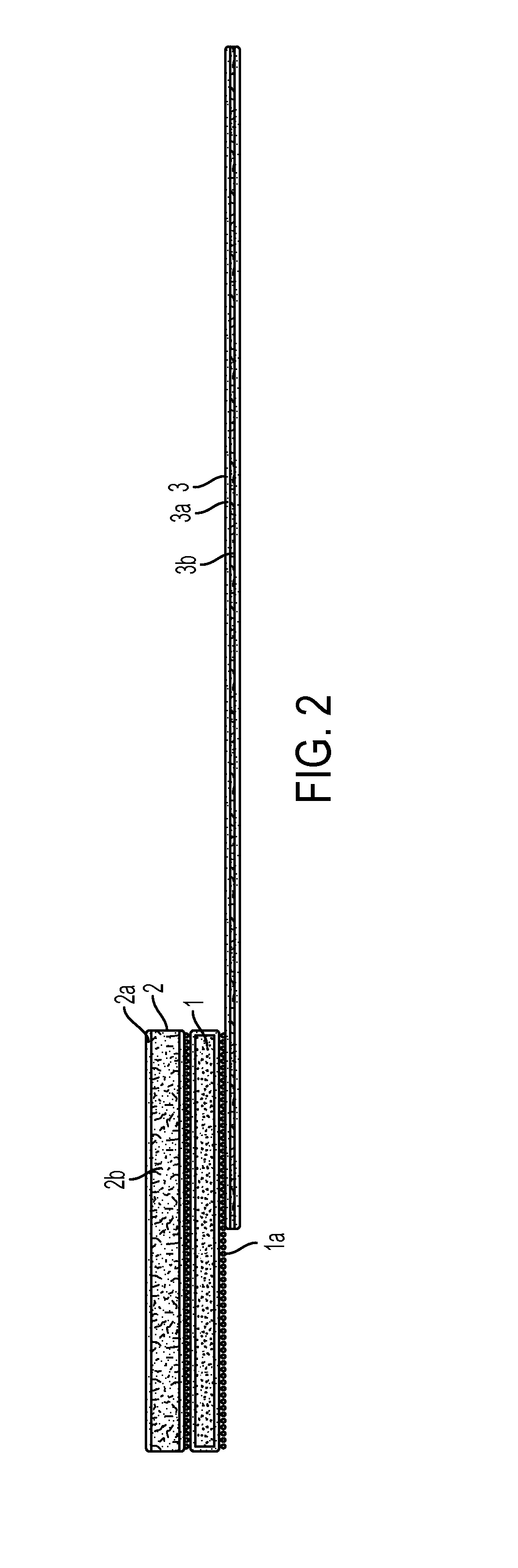 Arm restraint for iv site stability