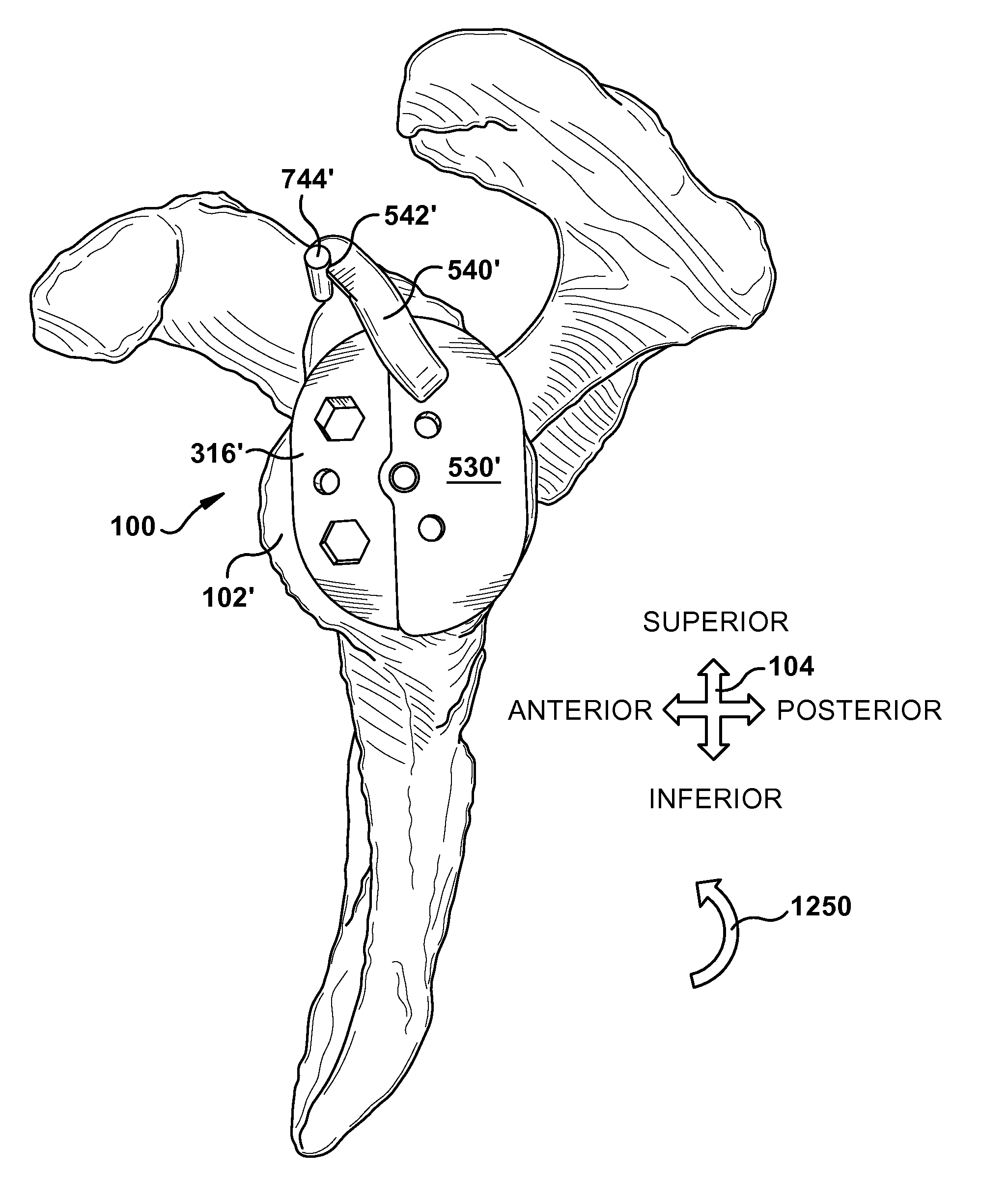 System and method for assisting with arrangement of a stock instrument with respect to a patient tissue