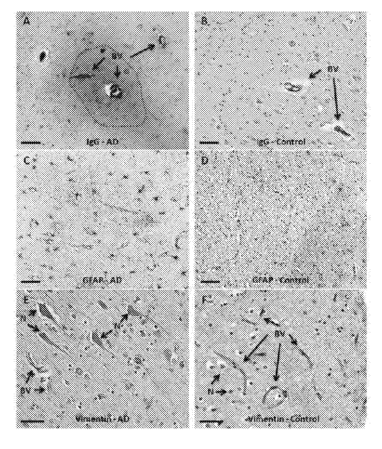 Novel slice cultures and methods for diagnosing neuronal degeneration diseases