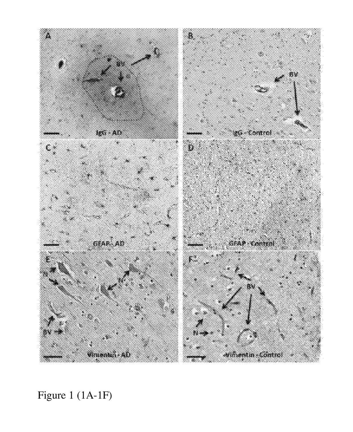 Novel slice cultures and methods for diagnosing neuronal degeneration diseases