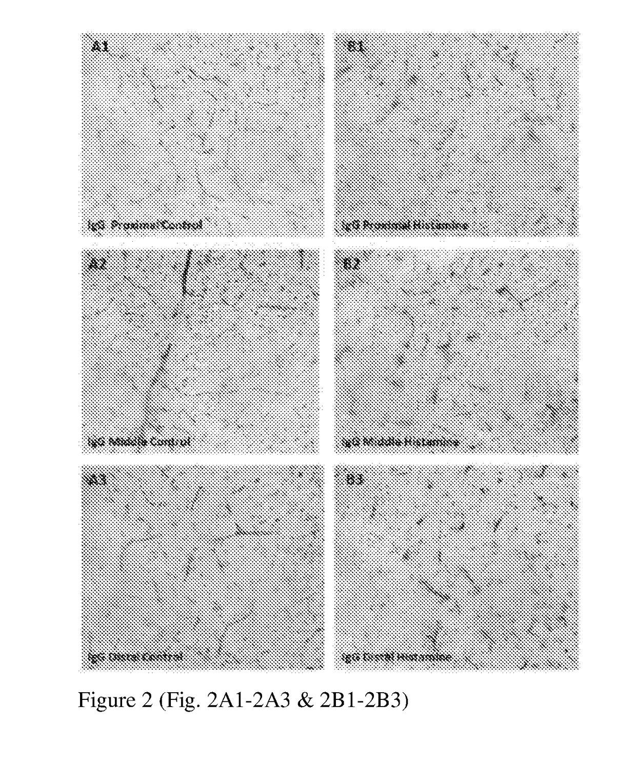 Novel slice cultures and methods for diagnosing neuronal degeneration diseases