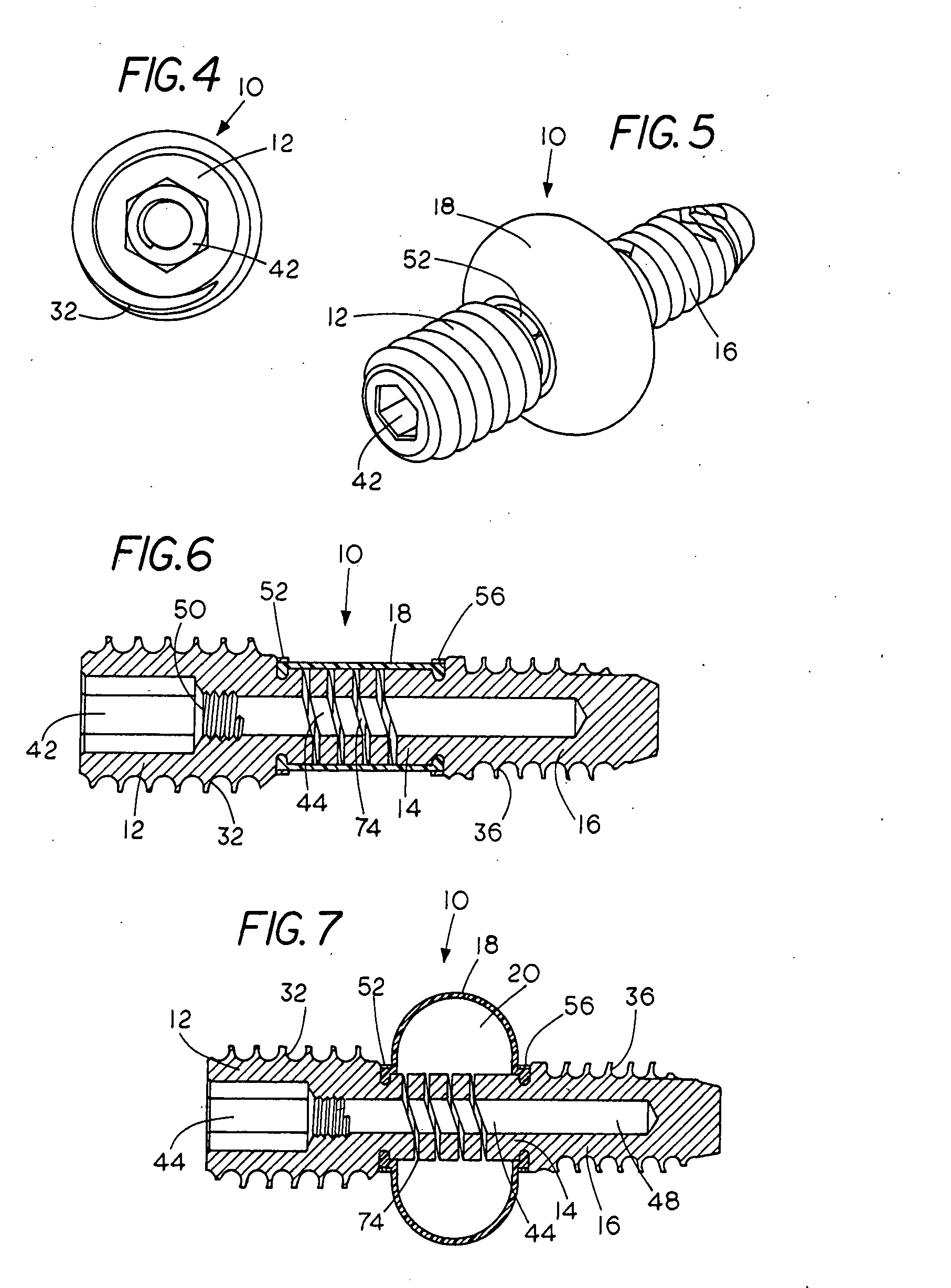 Spinal mobility preservation apparatus